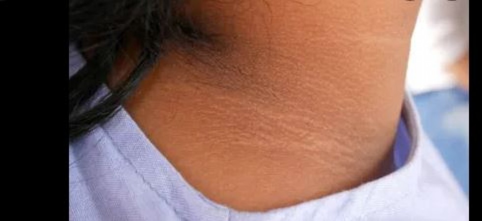 The neck has become black, so apply baking soda in this way