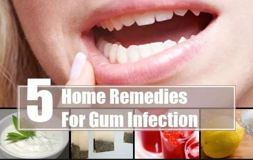 Relieve the discomfort of bleeding gums from these tips