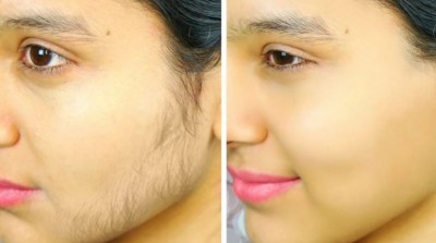 These 2 Home Remedies Are Most Effective For Removing Facial Hair