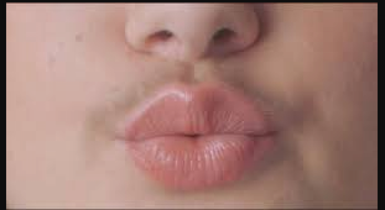 Try these home remedies to remove upper-lips hair