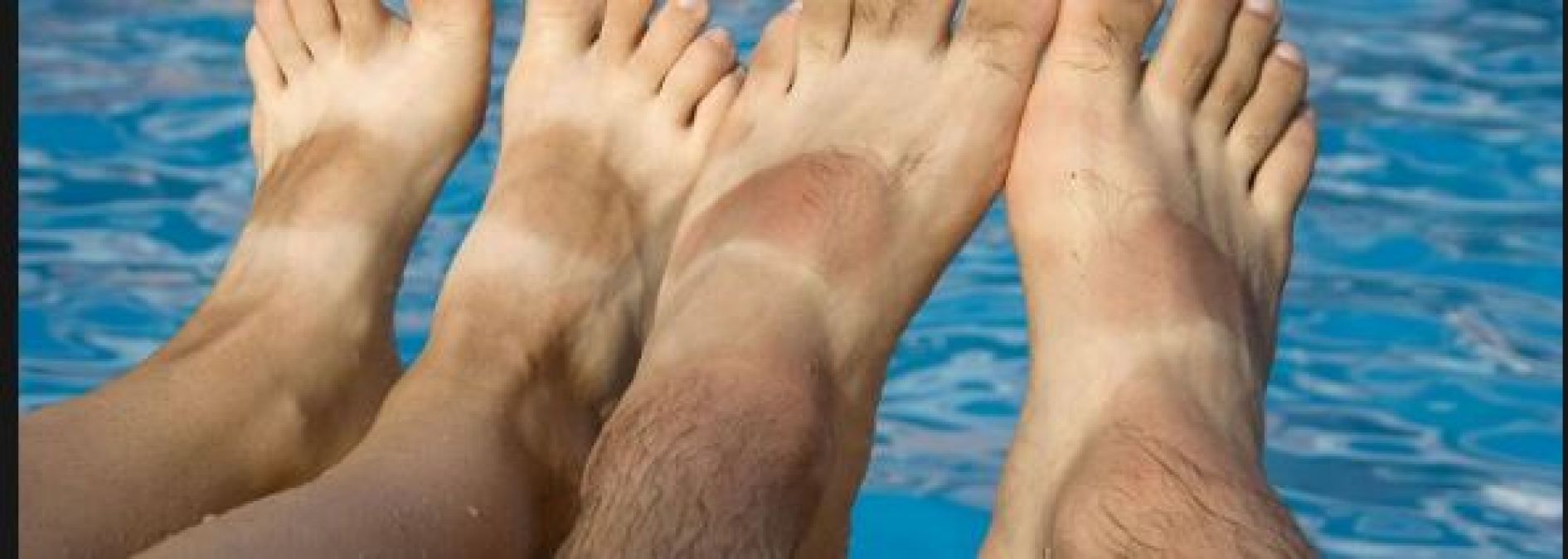 If you are troubled by sun tan, then embrace these simple and easiest tips