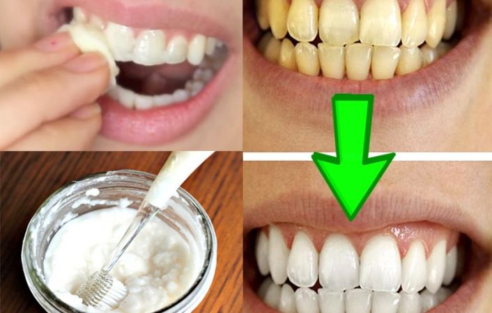 5 घरेलु तरीके चमका सकते हैं आपके दांतों को