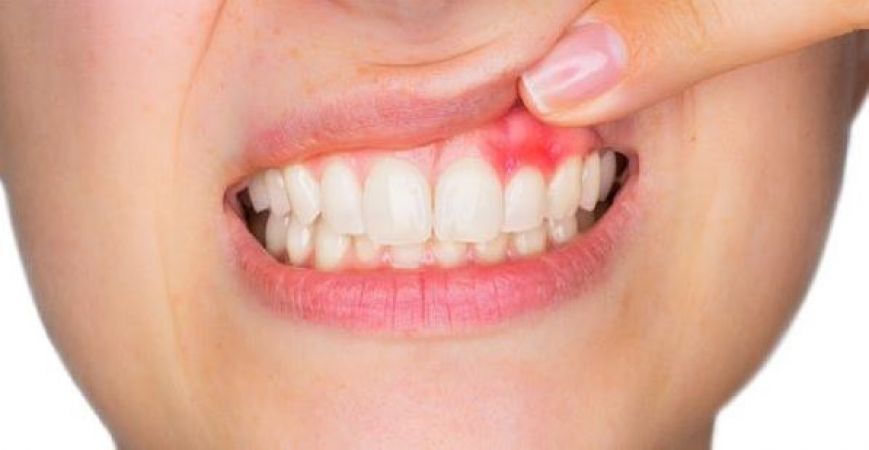 दांतों की सड़न और दर्द को दूर करेंगे घरेलु तरीके