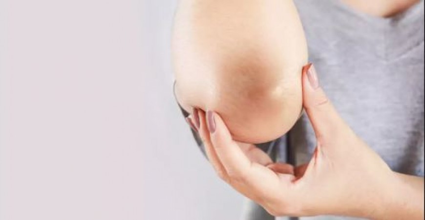 Coconut oil will instantly make elbows and knees white, use this way