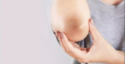 Coconut oil will instantly make elbows and knees white, use this way