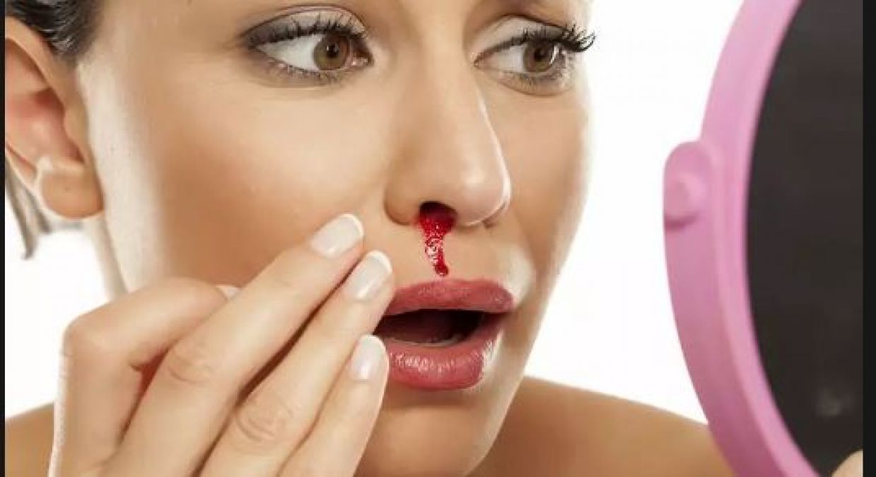 Bleeding from nose, then try these 3 most effective home remedies