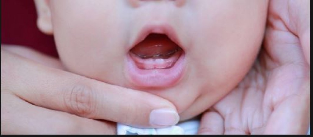 If the child is troubled by the arrival of milk teeth, then follow these home remedies