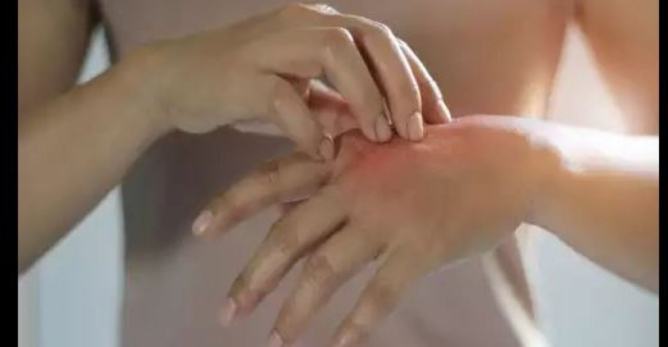 हो गई है स्किन एलर्जी तो तुलसी से लेकर एलोवेरा तक का करें इस्तेमाल