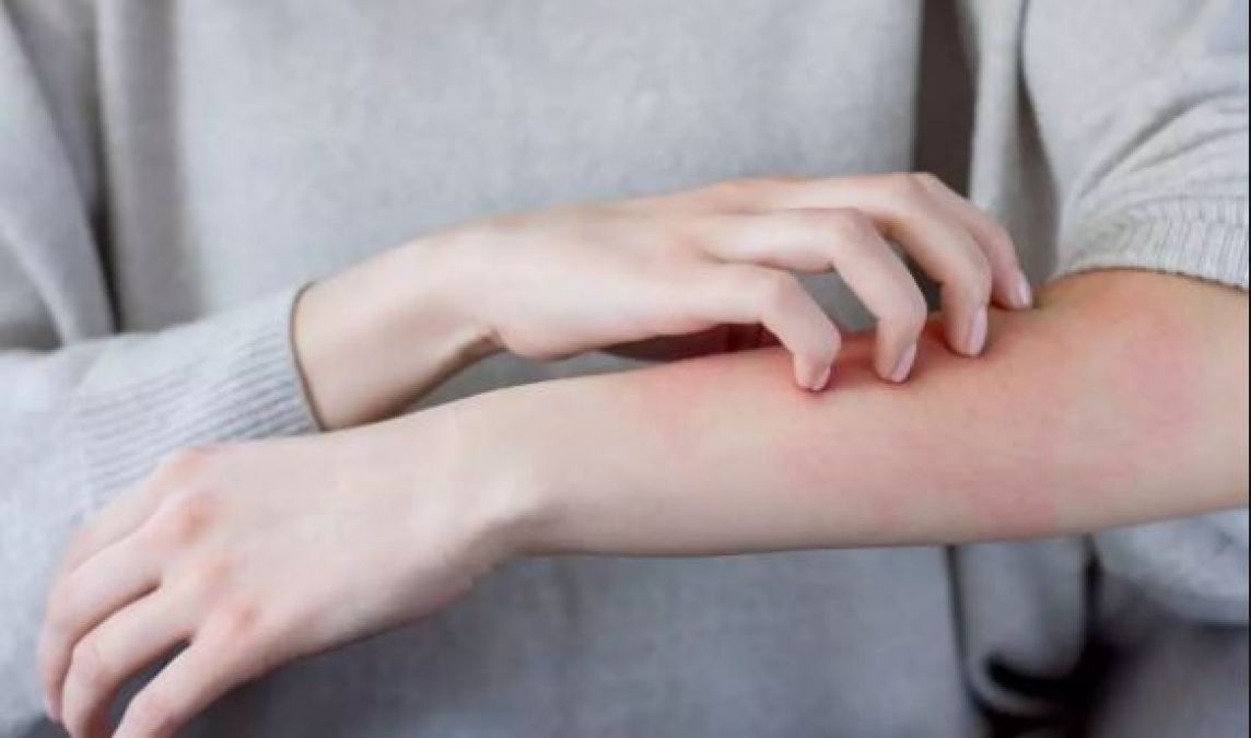 हो गई है स्किन एलर्जी तो तुलसी से लेकर एलोवेरा तक का करें इस्तेमाल