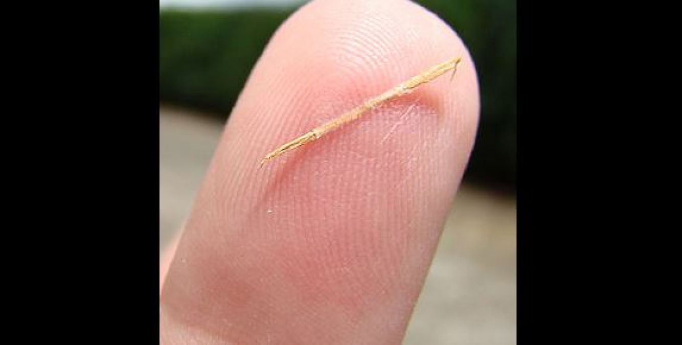A thorn stuck in the skin can become a canker, remove it with these home methods