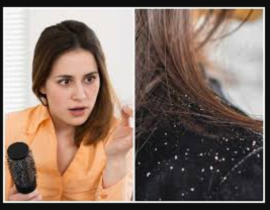 Follow these tips to get rid of hair problems during winters