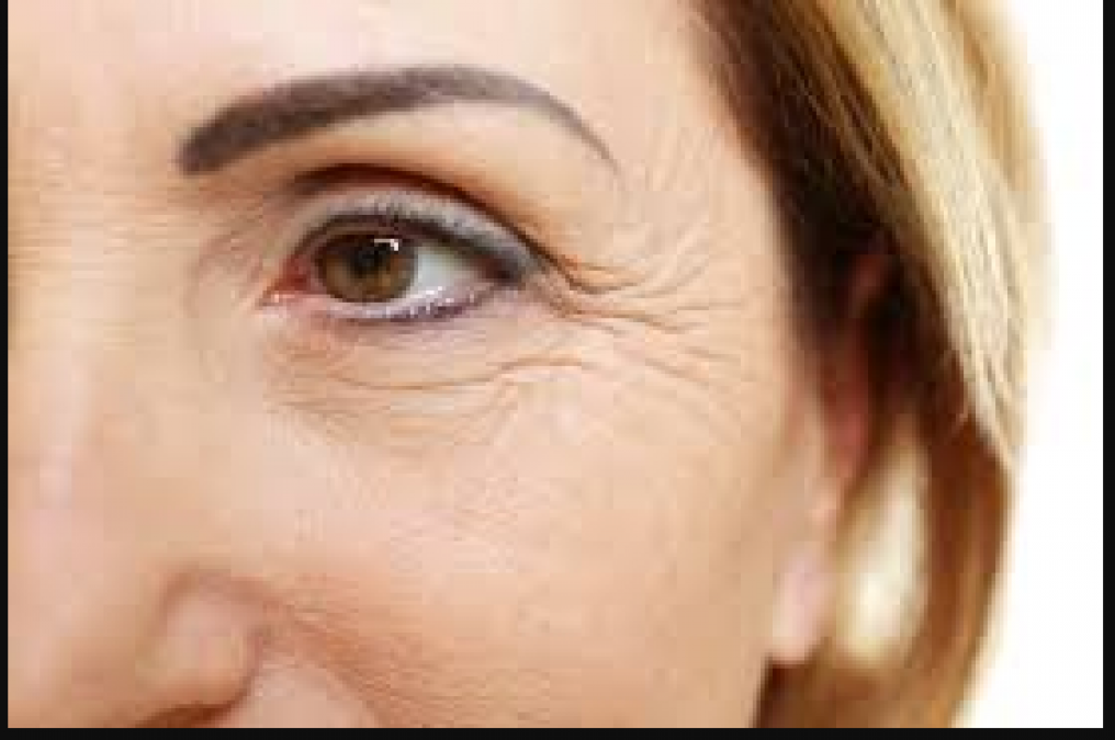 Follow these home remedies to remove wrinkles around the eyes