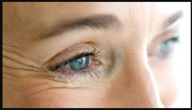Follow these home remedies to remove wrinkles around the eyes