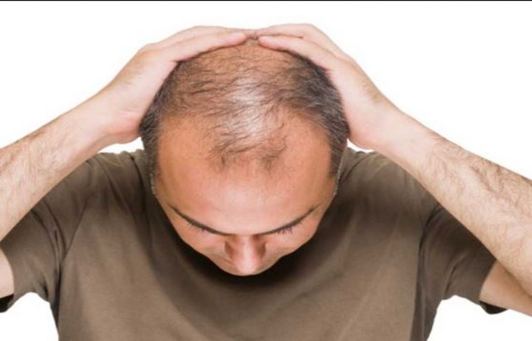 These tips will give relief from baldness