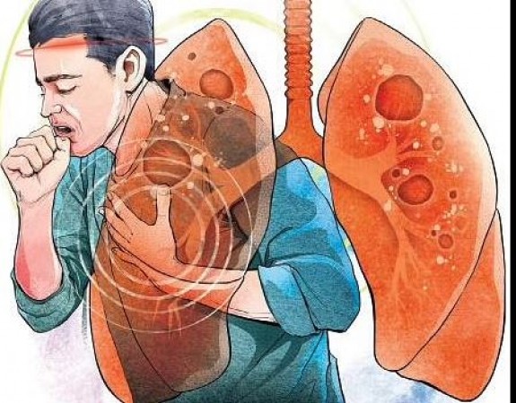 These big lies are spread about TB, people soon believe
