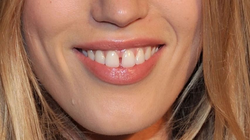 ज्योतिष के अनुसार बहुत कुछ बताता है दांतों के बीच का गैप