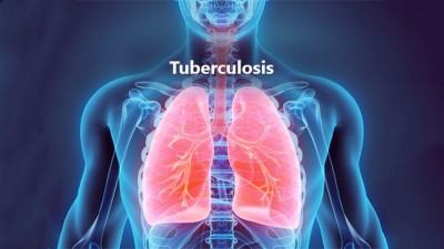 TN Health department to focus door-to-door TB screening