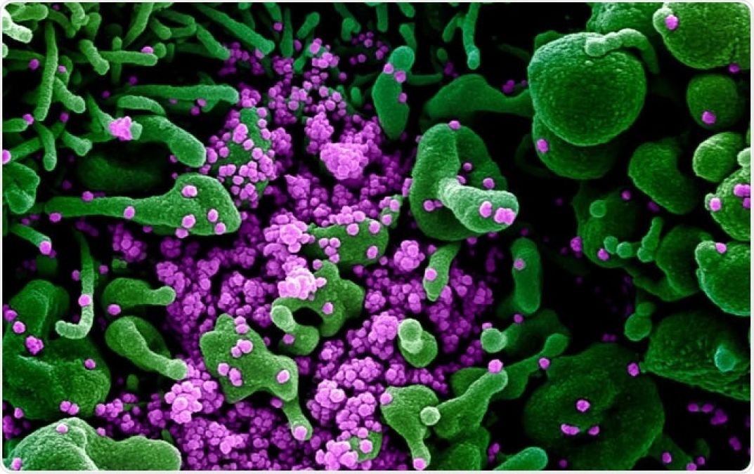 Researchers find that inhaling Nitric Oxide kills SARS-CoV-2