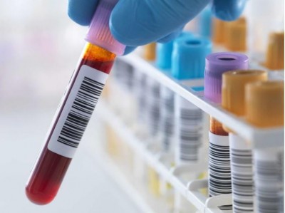 India's first unique blood group found in Gujarat man