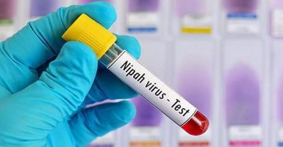 High Alert Issued in Kerala After Death of 14-Year-Old Boy from Nipah Virus