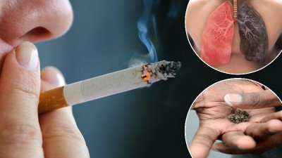 'Tobacco's Shadow': Rising consumption leading to a social pandemic, says Dr Acharya