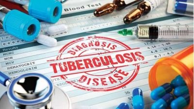 Doctors may face jail if failed to report TB cases
