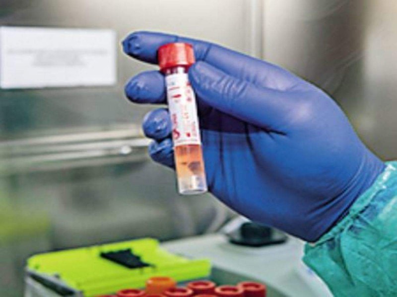 The total number of coronavirus cases in Andhra Pradesh rises to 20,31,974