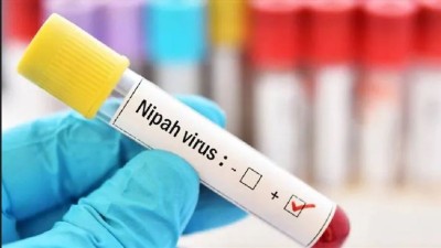 Malappuram Nipah Outbreak: 175 Identified in Contact List, 126 High-Risk Contacts