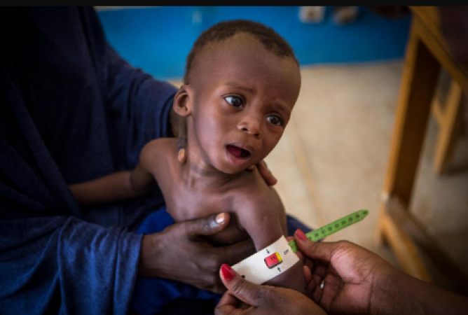 UNICEF: 12.7 million African children failed to receive their recommended vaccinations