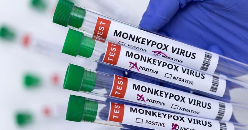 India Develops Home-Grown Monkeypox RT-PCR Testing Kit with CDSCO Approval