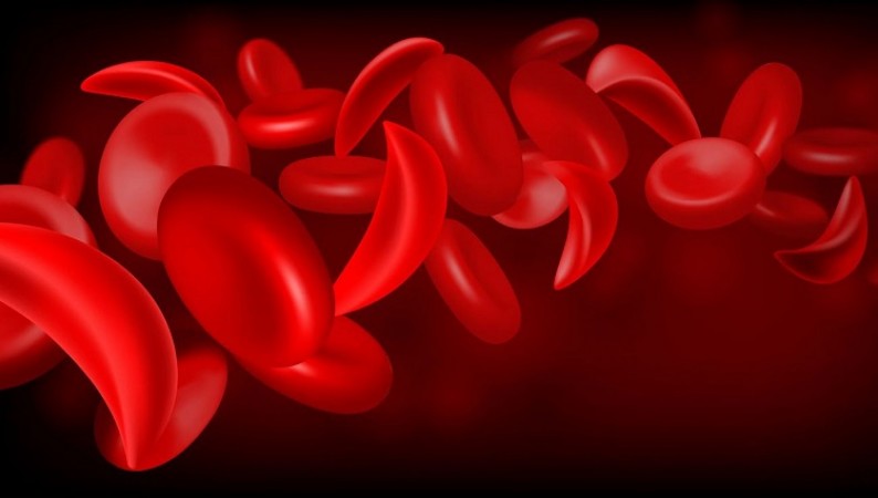 US Clears Groundbreaking Gene Editing Therapies for Sickle Cell Disease