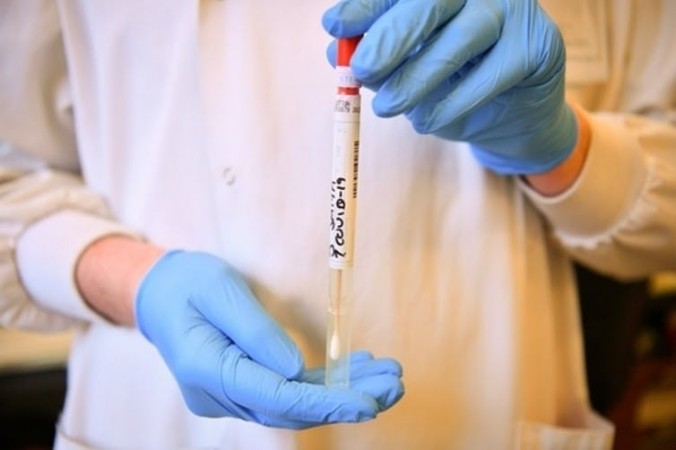 Australian researchers develop rapid Covid-19 test