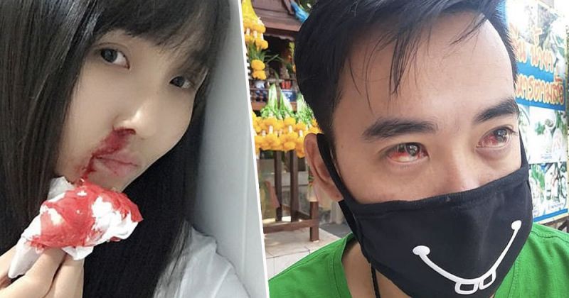 Bangkok people facing horrific bleeding noses and blood red eyes