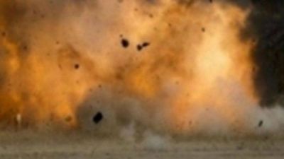 A bomb blast in Yamen, UAE photographer died and 20 injured