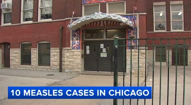 Chicago Measles Outbreak Raises Alarm: What Parents Must Know