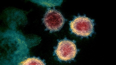 An Italian research study reveals another facts about Coronavirus infection