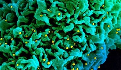 शीर्ष वैज्ञानिक ने कोरोनावायरस की उत्पत्ति की वास्तविक जांच करने का किया आह्वान