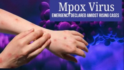 Africa CDC Raises Alarm Over Mpox Surveillance Amid Rising Cases