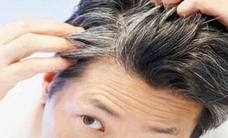 6 Home remedies to prevent premature grey hair