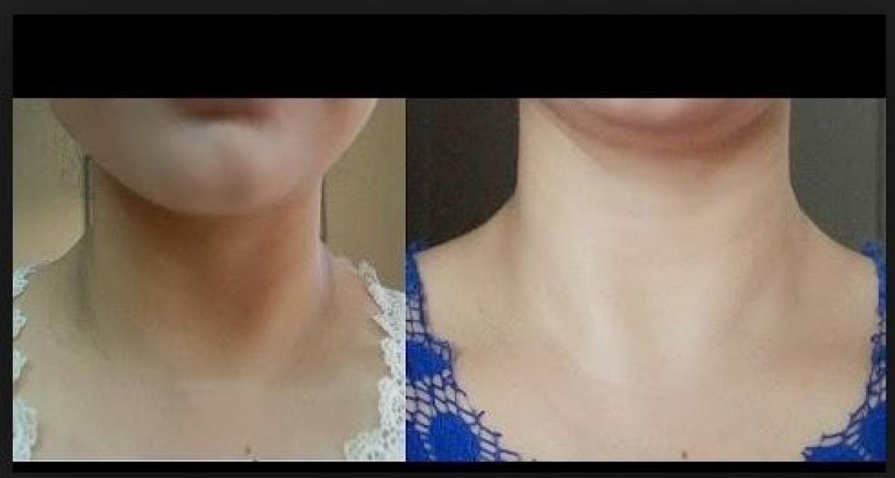 Does your face colour not match with Neck colour? Then this post is for you...read inside