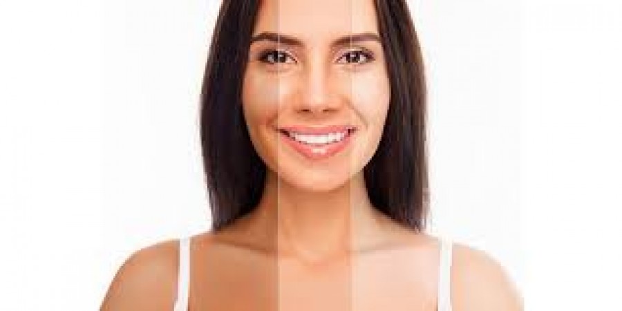 Do Skin Lightening Creams really work?