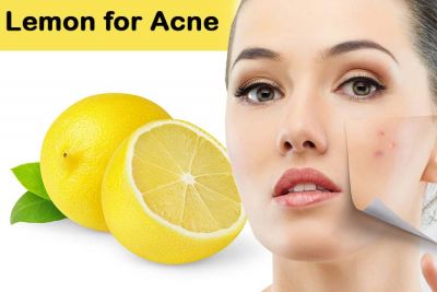 Lemon is the effective ingredient for removing pimples