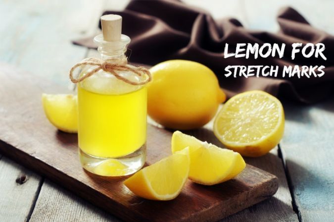 Use lemon juice to remove the stretch marks