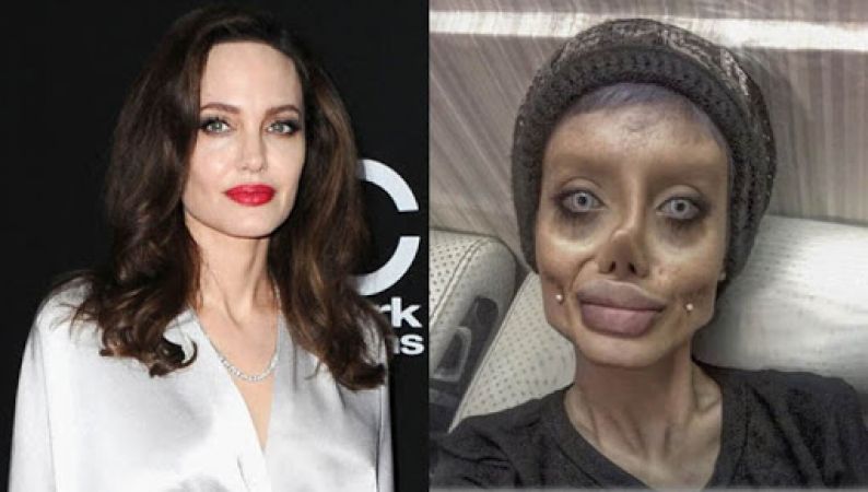 OMG! This girl tried 50 surgeries to look like Angelina Jolie