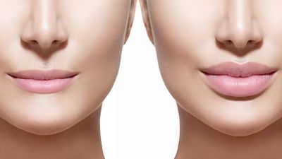 Get pout lips without surgery