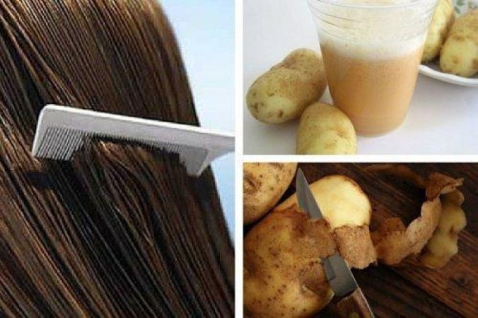 Potato juice will get rid of dandruff problem