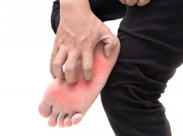 Are you troubled by itching and burning sensation in the soles of your feet? Adopt these simple remedies to get relief