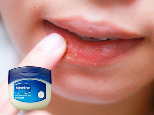How appropriate is it to apply Vaseline on lips?