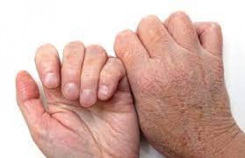 Hands are becoming dry in winter, so take care of them, these methods are very beneficial