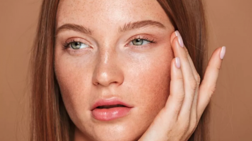 Facial freckles have reduced your beauty, so get glowing skin with this homemade face pack